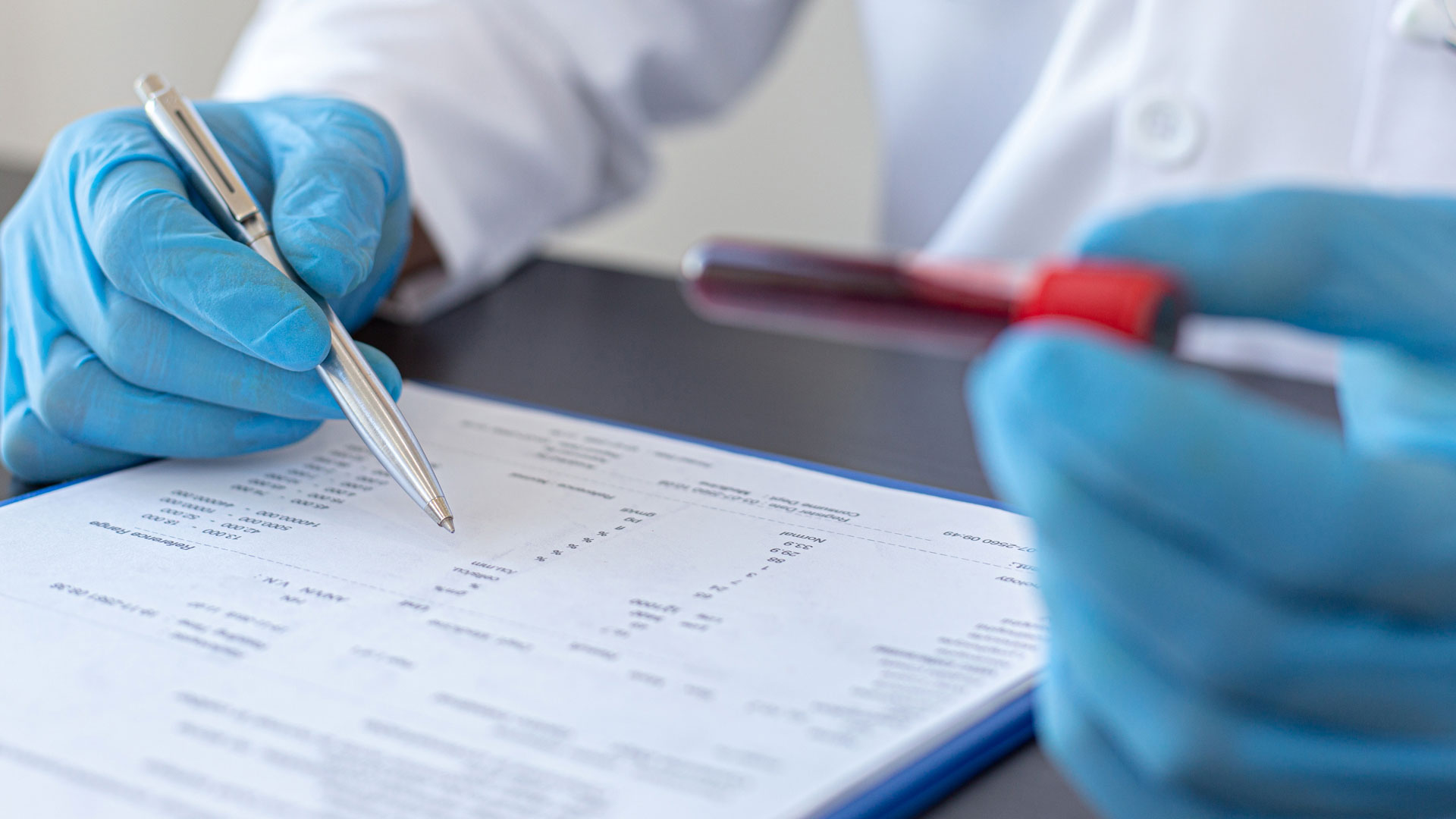 Physician analyzing blood sample